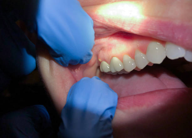 Best Emergency Root Canal Therapy in South Dennis, MA